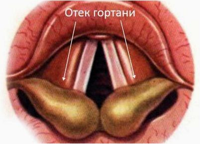 Влияние формальдегида на организм человека