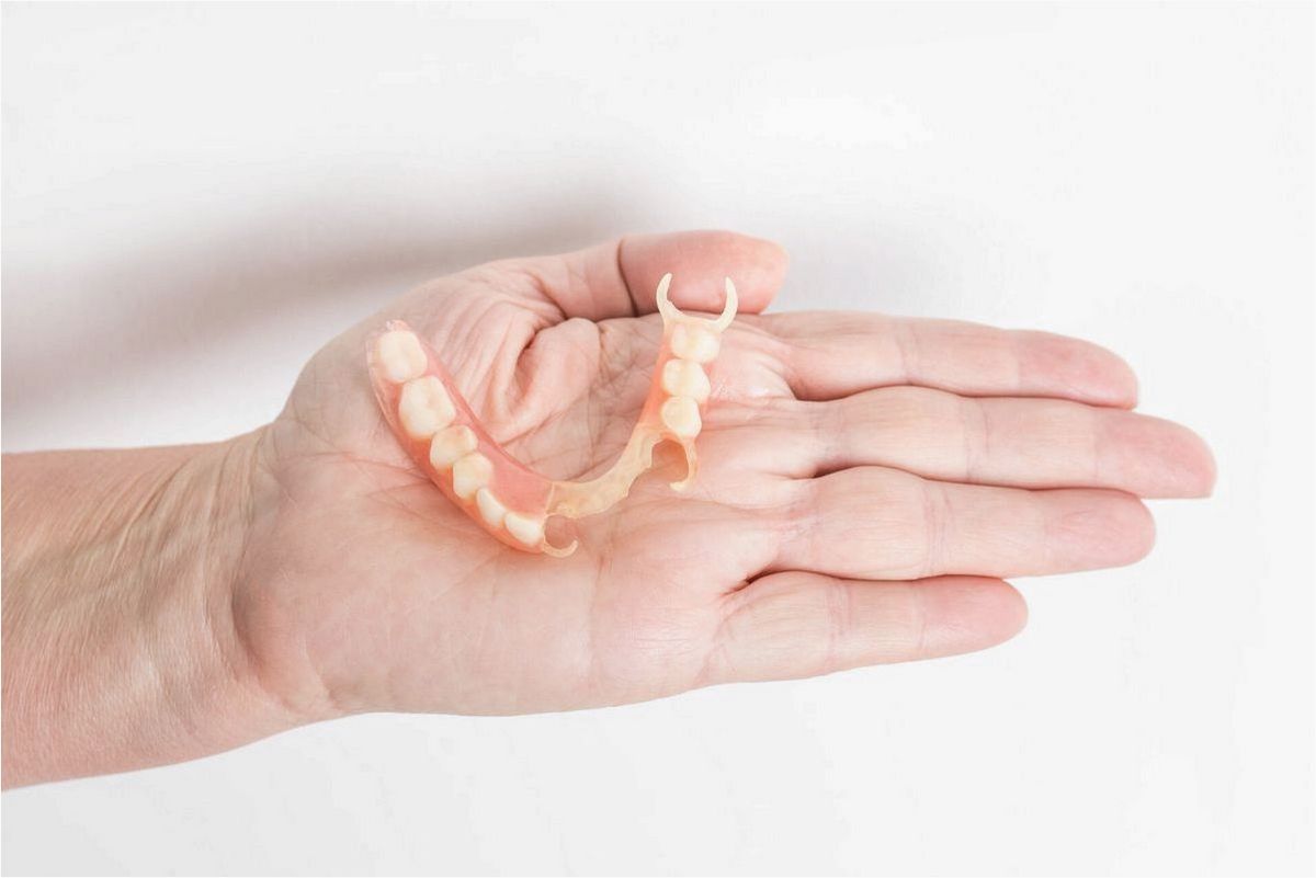 (плюсы, минусы, съемных, протезов) Pros and cons of removable dentures