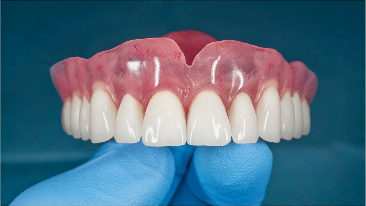 (плюсы, минусы, съемных, протезов) Pros and cons of removable dentures