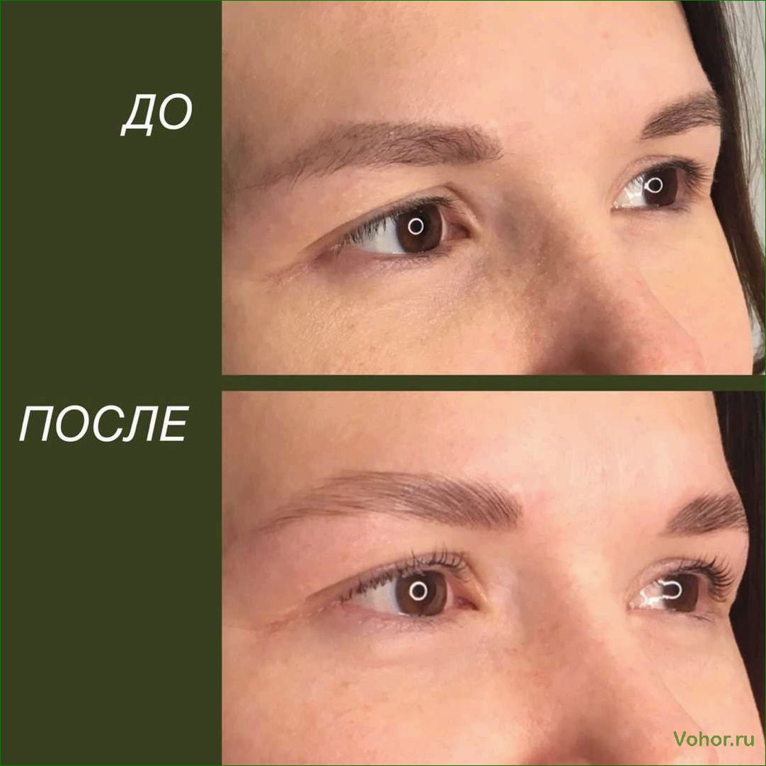 (брови, ботокса, изменяется, внешний)